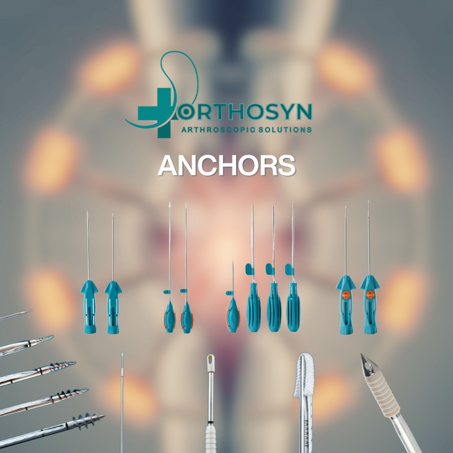 Arthroscopy