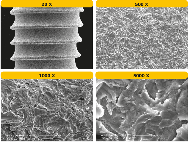 OptimOss Surface